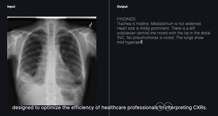 카라-CXR. (사진=카카오브레인)