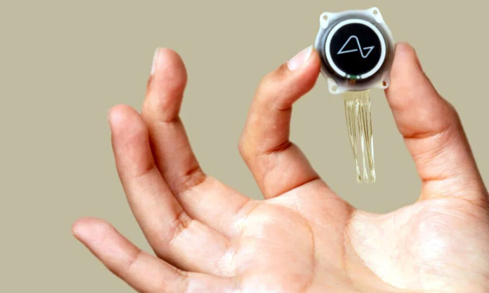 뉴럴링크 BCI 칩 뇌 이식 환자…생각만으로 월드오브워크래프트 게임 즐겼다